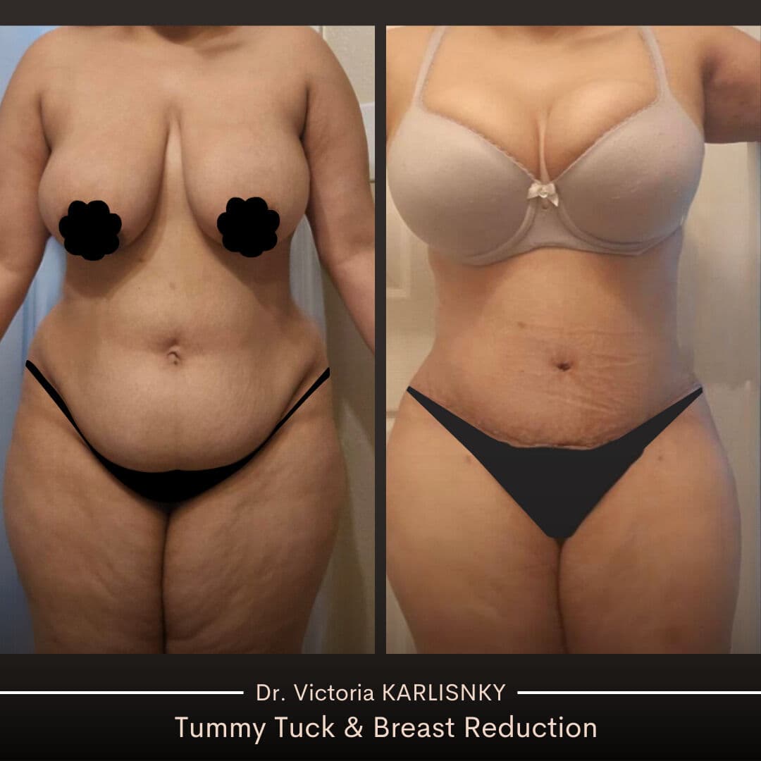 Instagram post from alluringplasticsurgery