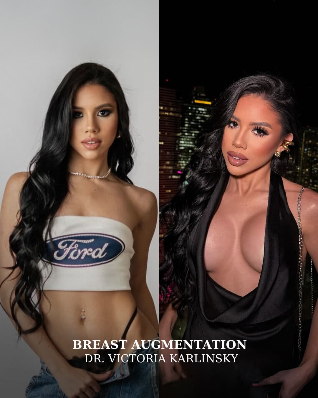Instagram carousel item from alluringplasticsurgery